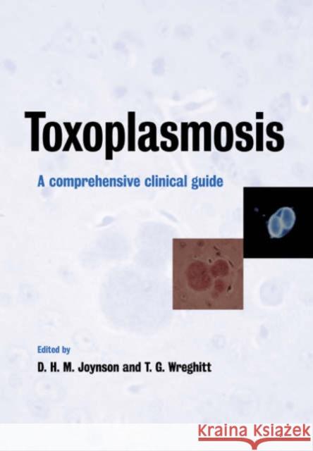 Toxoplasmosis: A Comprehensive Clinical Guide Joynson, David H. M. 9780521019422 Cambridge University Press