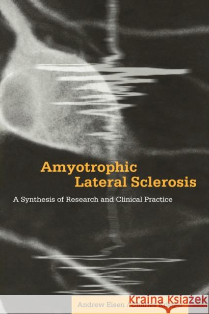 Amyotrophic Lateral Sclerosis: A Synthesis of Research and Clinical Practice Andrew Eisen (University of British Columbia, Vancouver), Charles Krieger (University of British Columbia, Vancouver) 9780521034265