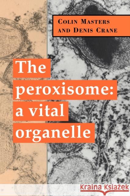 The Peroxisome: A Vital Organelle Masters, Colin 9780521036832 Cambridge University Press