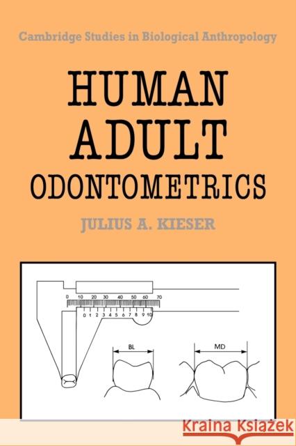 Human Adult Odontometrics: The Study of Variation in Adult Tooth Size Kieser, Julius A. 9780521064590 Cambridge University Press