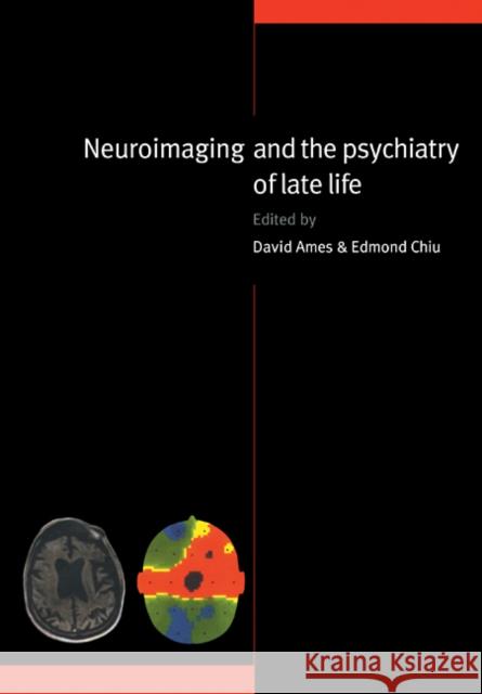 Neuroimaging and the Psychiatry of Late Life David Ames Edmond Chiu Raymond Levy 9780521112475 Cambridge University Press