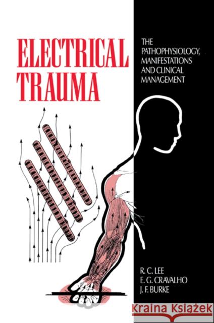 Electrical Trauma: The Pathophysiology, Manifestations and Clinical Management Lee, R. C. 9780521116145 Cambridge University Press