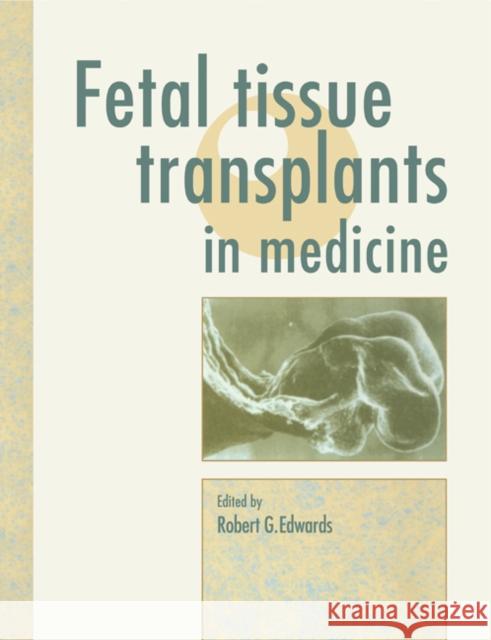 Fetal Tissue Transplants in Medicine Robert G. Edwards 9780521116923 Cambridge University Press