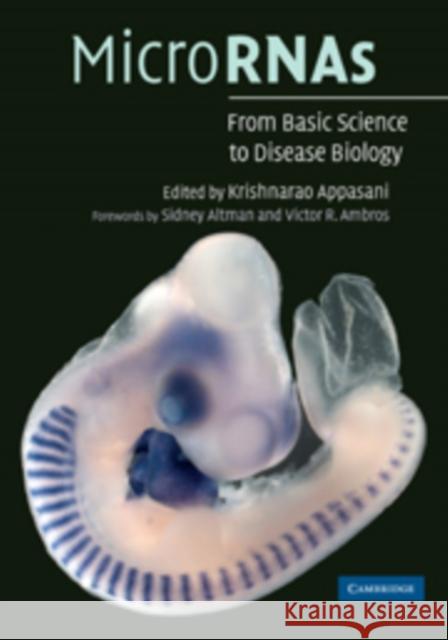 Micrornas: From Basic Science to Disease Biology Appasani, Krishnarao 9780521118552