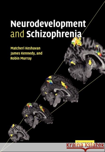 Neurodevelopment and Schizophrenia Matcheri S. Keshavan James L. Kennedy Robin M. Murray 9780521126595