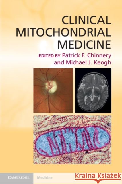 Clinical Mitochondrial Medicine Patrick Chinnery Michael Keogh 9780521132985 Cambridge University Press