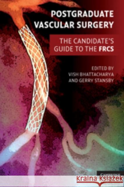 Postgraduate Vascular Surgery: The Candidate's Guide to the FRCS Bhattacharya, Vish 9780521133524 CAMBRIDGE UNIVERSITY PRESS