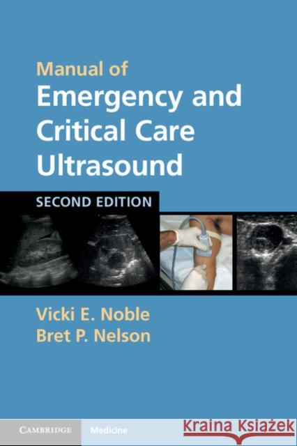 Manual of Emergency and Critical Care Ultrasound Vicki Noble 9780521170918