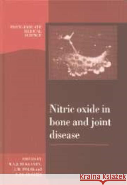 Nitric Oxide in Bone and Joint Disease Mika V. J. Hukkanen Julia M. Polak Sean P. F. Hughes 9780521175135 Cambridge University Press