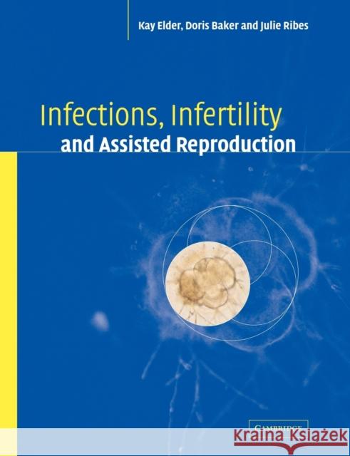 Infections, Infertility, and Assisted Reproduction Kay Elder Doris J. Baker Julie A. Ribes 9780521178518 Cambridge University Press