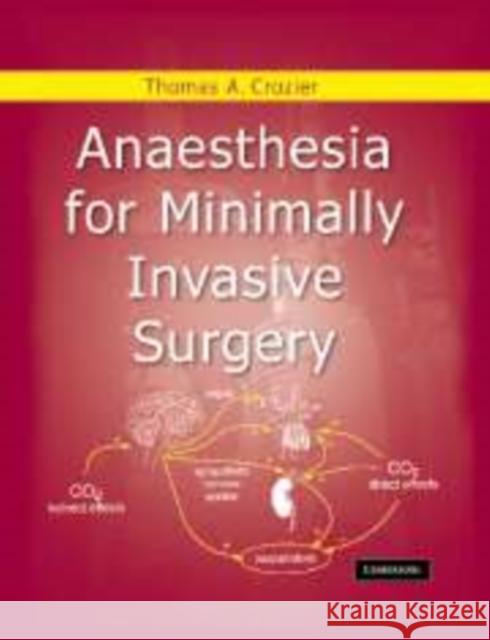 Anaesthesia for Minimally Invasive Surgery Thomas Allen Crozier 9780521179775 Cambridge University Press