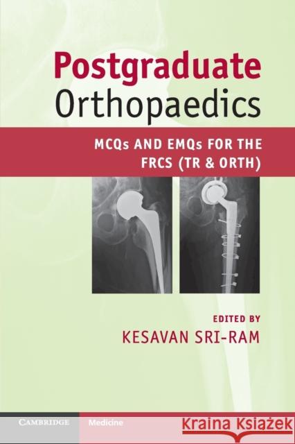 Postgraduate Orthopaedics Sri-Ram, Kesavan 9780521184717