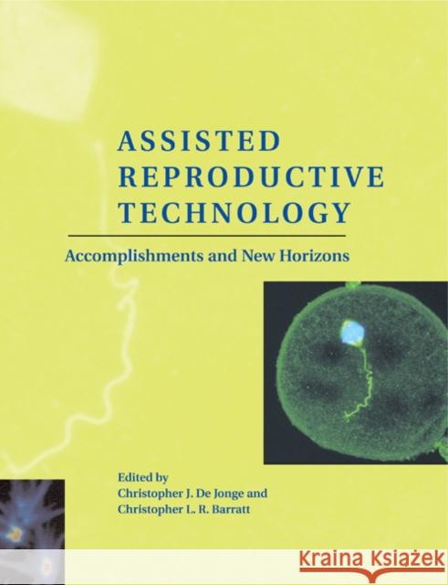 Assisted Reproductive Technology: Accomplishments and New Horizons de Jonge, Christopher J. 9780521188951 Cambridge University Press