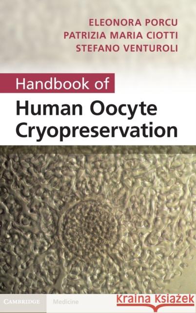 Handbook of Human Oocyte Cryopreservation Eleonora Porcu 9780521192392 0