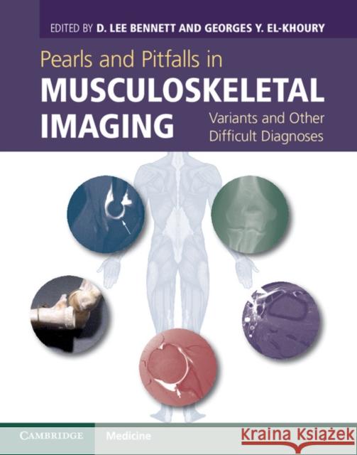 Pearls and Pitfalls in Musculoskeletal Imaging: Variants and Other Difficult Diagnoses Bennett, D. Lee 9780521196321 0