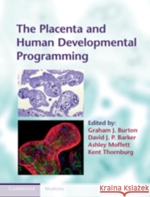 The Placenta and Human Developmental Programming Graham J Burton 9780521199452