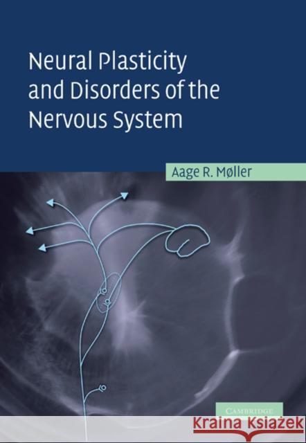 Neural Plasticity and Disorders of the Nervous System Aage R. Moller 9780521248952
