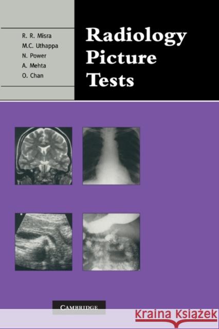 Radiology Picture Tests: Film Viewing and Interpretation for Part 1 Frcr Misra, Rakesh R. 9780521280891 Cambridge University Press
