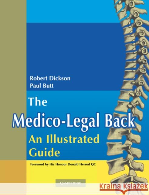 The Medico-Legal Back: An Illustrated Guide Robert A. Dickson W. Paul Butt 9780521283205 Cambridge University Press