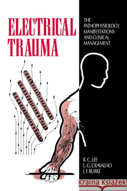 Electrical Trauma: The Pathophysiology, Manifestations, and Clinical Management Lee, R. C. 9780521383455 Cambridge University Press