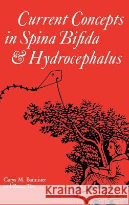 Current Concepts in Spina Bifida and Hydrocephalus Carys M. Bannister, Brian Tew 9780521412797 Cambridge University Press