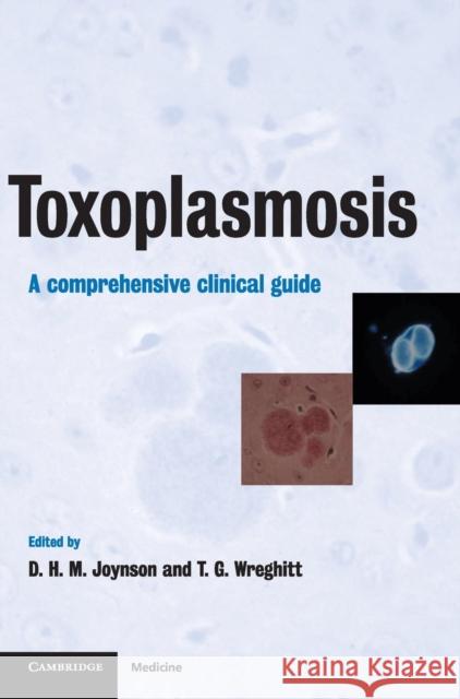 Toxoplasmosis: A Comprehensive Clinical Guide David H. M. Joynson (Singleton Hospital, Swansea), Tim G. Wreghitt (Addenbrooke's Hospital, Cambridge) 9780521443289 Cambridge University Press