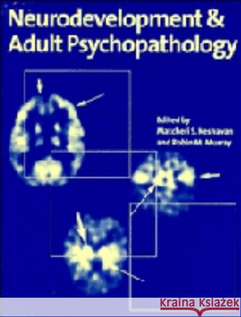 Neurodevt & Adult Psychopathology Keshavan, Matcheri S. 9780521485654