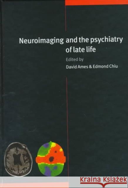 Neuroimaging and the Psychiatry of Late Life David Ames Edmond Chiu Raymond Levy 9780521495059 Cambridge University Press
