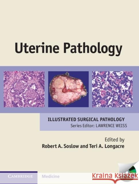 Uterine Pathology Robert Soslow 9780521509800