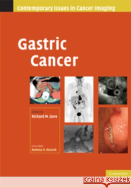 Gastric Cancer Richard M Gore 9780521513838