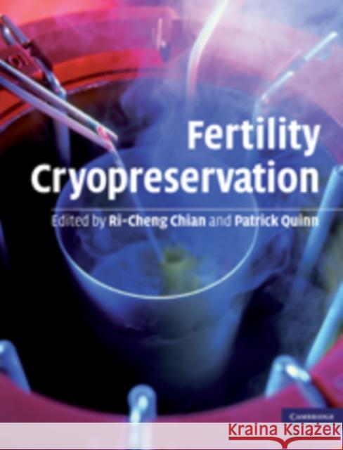 Fertility Cryopreservation Ri-Cheng Chian 9780521517782 0