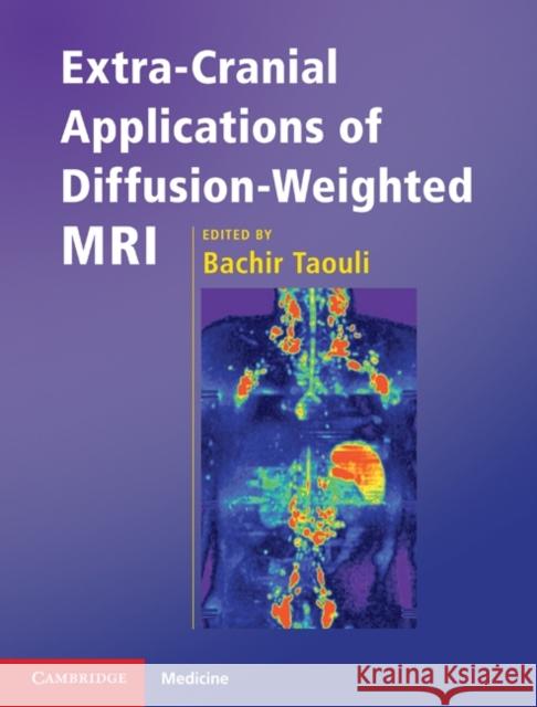 Extra-Cranial Applications of Diffusion-Weighted MRI Bachir Taouli 9780521518697 0