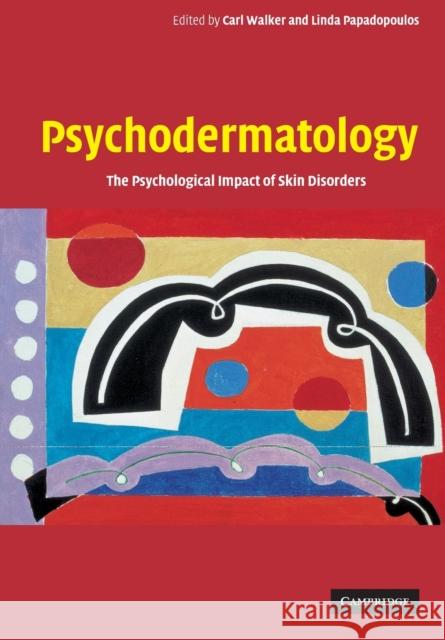 Psychodermatology: The Psychological Impact of Skin Disorders Walker, Carl 9780521542296