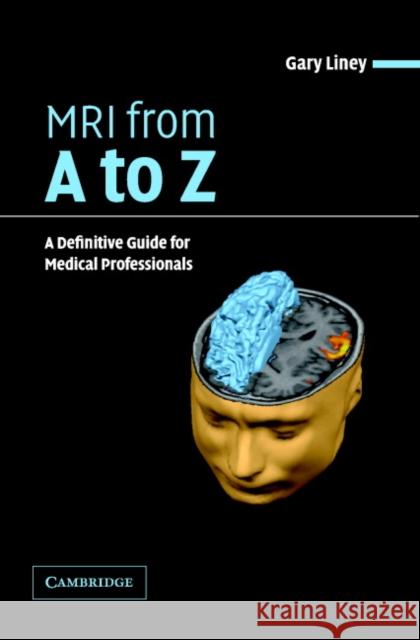 MRI from A to Z: A Definitive Guide for Medical Professionals Liney, Gary 9780521606387 Cambridge University Press