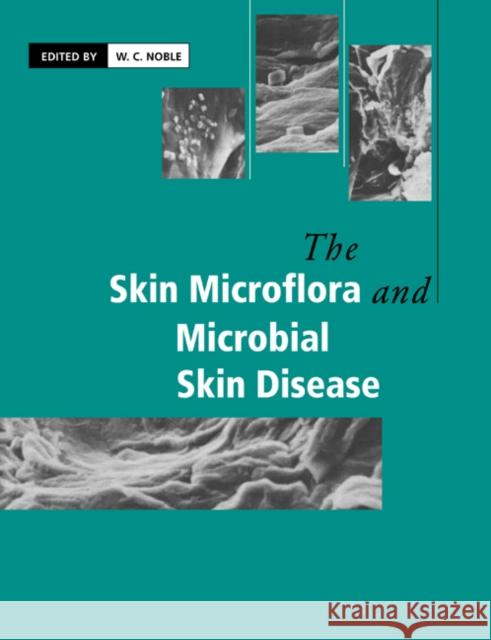 The Skin Microflora and Microbial Skin Disease W. C. Noble 9780521612067 Cambridge University Press