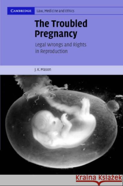 The Troubled Pregnancy : Legal Wrongs and Rights in Reproduction J. K. Mason 9780521616249 Cambridge University Press