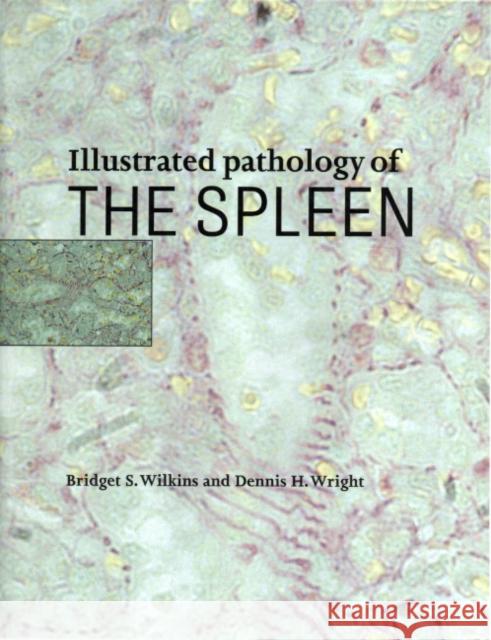 Illustrated Pathology of the Spleen Bridget S. Wilkins Dennis H. Wright 9780521622271 Cambridge University Press