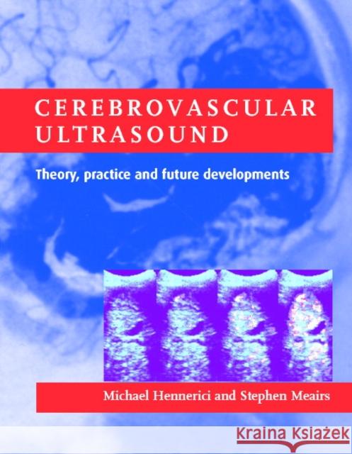 Cerebrovascular Ultrasound : Theory, Practice and Future Developments Michael Hennerici Stephen Meairs 9780521632232 Cambridge University Press
