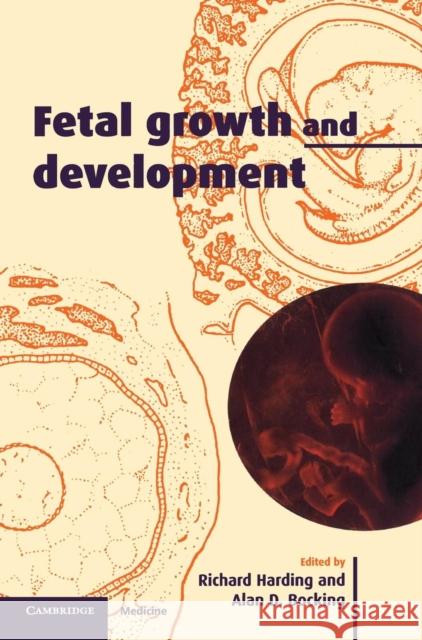 Fetal Growth and Development Alan D. Bocking Richard Harding 9780521642378 Cambridge University Press