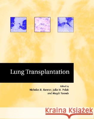 Lung Transplantation Nicholas R. Banner Magdi Yacoub Magdy H. Yacoub 9780521651110 Cambridge University Press