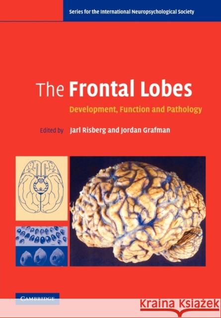 The Frontal Lobes: Development, Function and Pathology Risberg, Jarl 9780521672252 Cambridge University Press