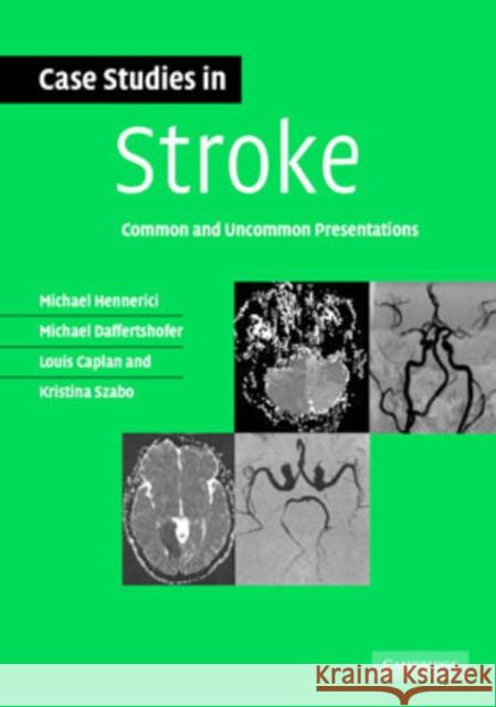 Case Studies in Stroke: Common and Uncommon Presentations Hennerici, Michael G. 9780521673679 0