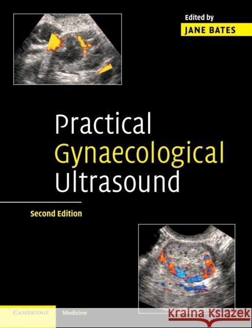 Practical Gynaecological Ultrasound Jane Bates 9780521674508