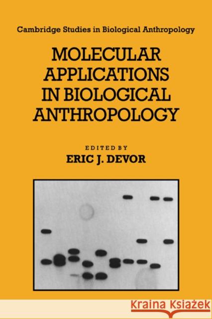 Molecular Applications in Biological Anthropology Eric J. Devor C. G. Nicholas Mascie-Taylor R. A. Foley 9780521675529 Cambridge University Press