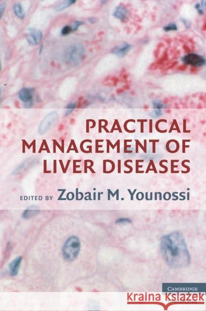 Practical Management of Liver Diseases  9780521684897 CAMBRIDGE UNIVERSITY PRESS