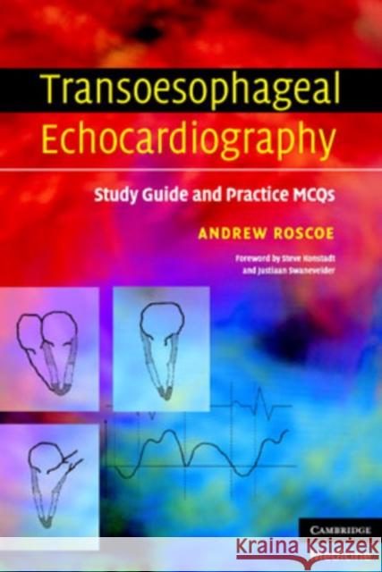 Transoesophageal Echocardiography: Study Guide and Practice Questions Roscoe, Andrew 9780521689601 0