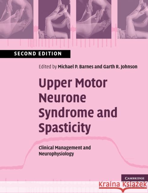 Upper Motor Neurone Syndrome and Spasticity: Clinical Management and Neurophysiology Barnes, Michael P. 9780521689786 0