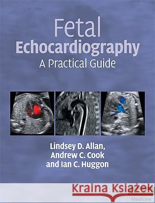 Fetal Echocardiography: A Practical Guide [With DVD] Allan, Lindsey D. 9780521695206 0