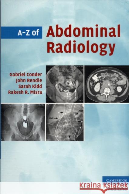 A-Z of Abdominal Radiology Rakesh Misra Gabriel Conder 9780521700146 CAMBRIDGE UNIVERSITY PRESS