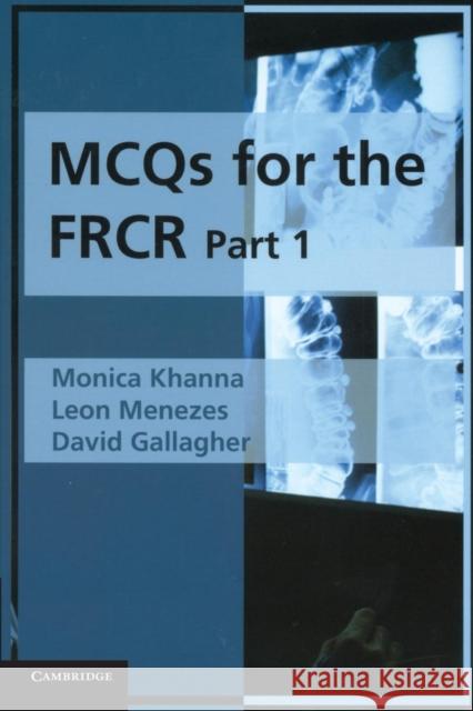 MCQs for the FRCR, Part 1 Monica Khanna Leon Menezes David Gallagher 9780521705653 Cambridge University Press